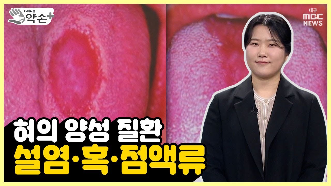 혀의 양성 질환-설염·혹·점액류 [내 몸이 보내는 건강 신호 ‘혀 질환’ ⑦] | 메디컬 약손 - YouTube