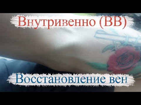 Видео: Как восстановить поврежденные вены: 13 шагов (с иллюстрациями)