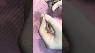 Biomecánicas para enderezar molares!