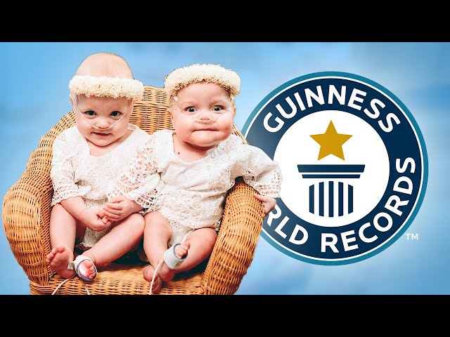 Most Premature Twins - Guinness World Records class=
