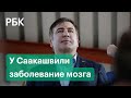 Врачи нашли у Саакашвили заболевание мозга, экс-президента Грузии перевели в военный госпиталь