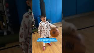 Nolan goes home after burn treatment - Akron Children's video