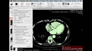 Generating 3D models using Osirix