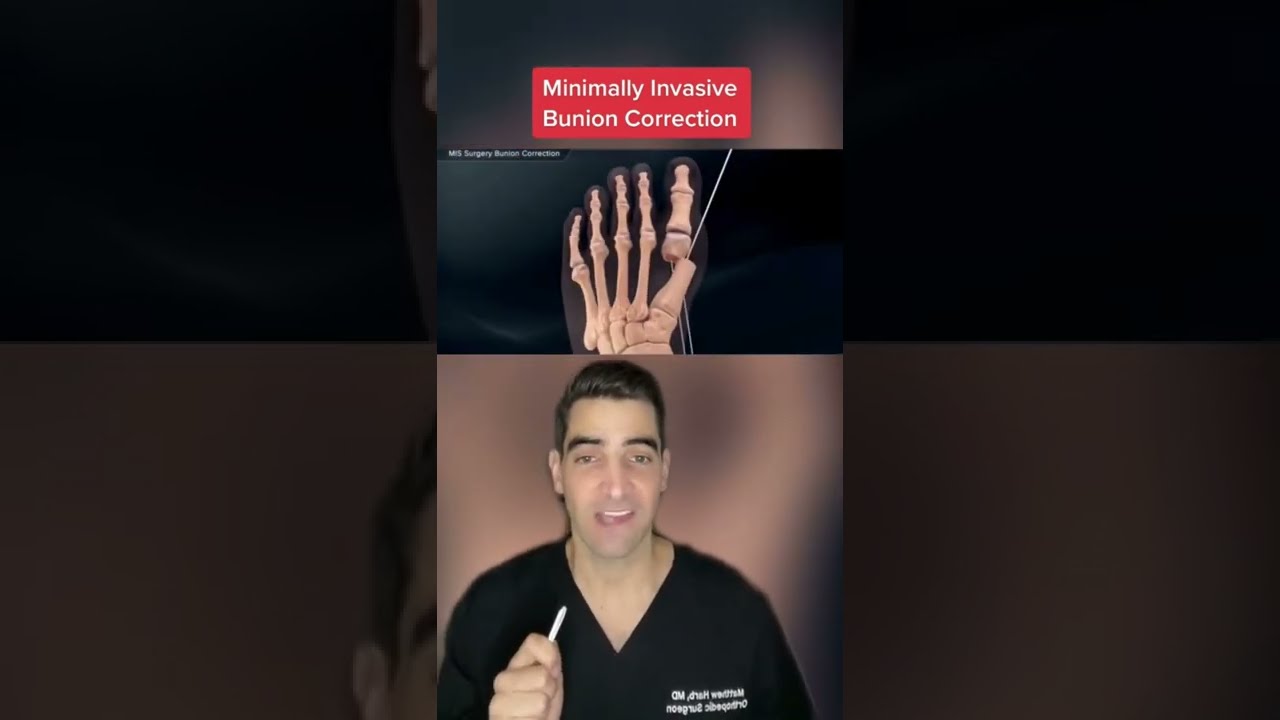 Bunion Correction