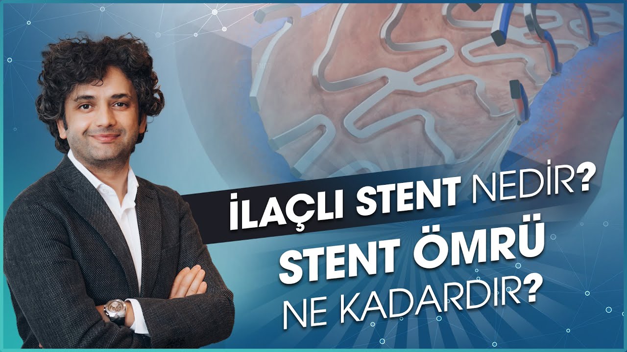 Stent 10 Stent