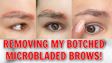 I FINALLY REMOVED MY TATTOOED EYEBROWS ... 😪