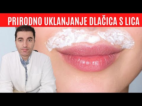 Prirodno uklanjanje DLAČICA SA LICA