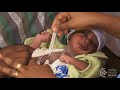 Danger Signs in the Small Baby (Ga) - Small Baby Series