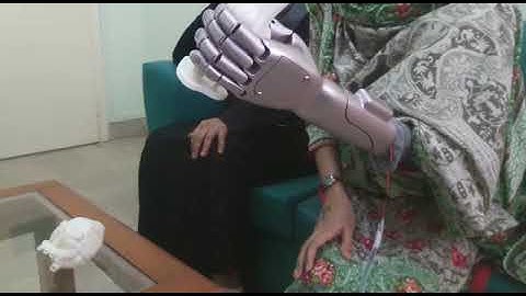 Smart Prosthetics Arms - Brain-controlled and AI embedded!