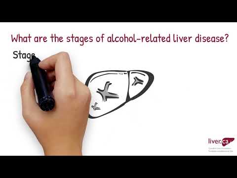 Video: Hur man läker levern från alkoholism: 15 steg (med bilder)