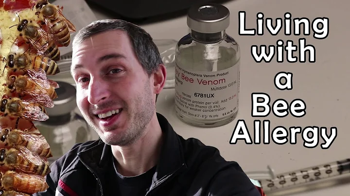 Allergic to bees... and I'm a beekeeper