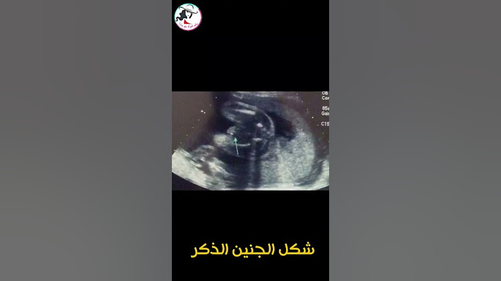 شكل الجنين الذكر على السونار