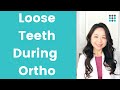 Loose teeth  mobility with orthodontic treatment l dr melissa bailey