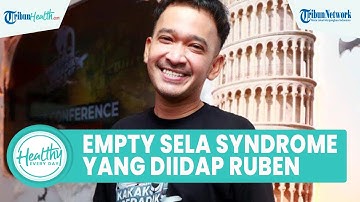 Mengenal Empty Sella Syndrome, Penyakit Langka yang Diidap Ruben Onsu, Ini Gejala dan Cara Atasi