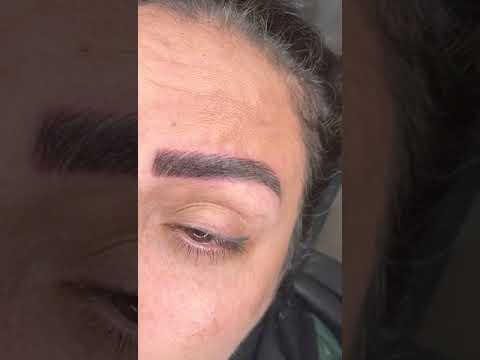 فیبروز هایپر لیفت روی تتوی قدیمی و کم مو