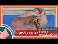 Liver Anatomy and Function Quiz