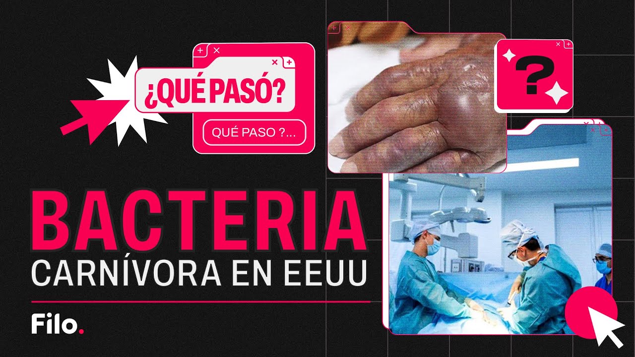 Bacteria carnívora en Estados Unidos | Qué Pasó