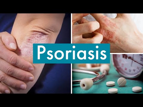 PSORIASIS ( CAUSES , SYMPTOMES , COMPLICATIONS ET TRAITEMENT )