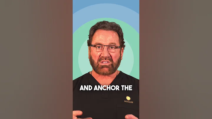 How long does an endoscopic facelift last?