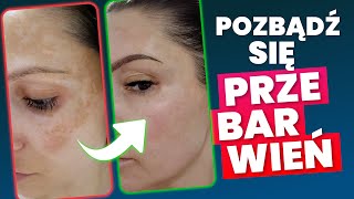 PRZEBARWIENIA - jak pozbyć się plam posłonecznych? Historia skóry skin ekspertki Kasi!