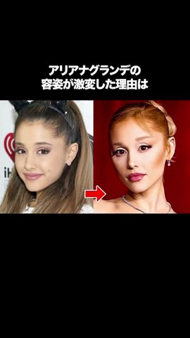 アリアナグランデが激痩せした理由