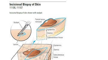 Biopsy procedure types and guidelines in Skin chapter in detail