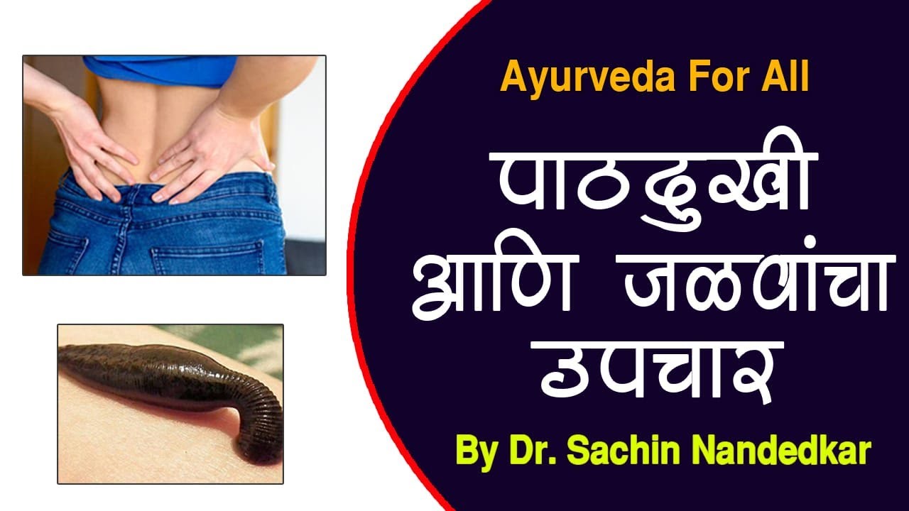 पाठ व कंबर दुखी जळवा उपचार / Back pain Leech Therapy / Ayurveda for All
