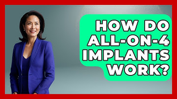 How Do All-on-4 Implants Work? - The Operating Table