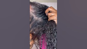 #psoriasis #dermatitis #naturalhair #naturalhaircare #shorts #washdayroutine #scalpcare