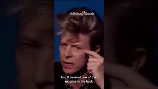 David Bowie's Eyes