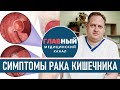 Симптомы рака кишечника. Колоректальный рак прямой и толстой кишки. Как понять что у тебя рак