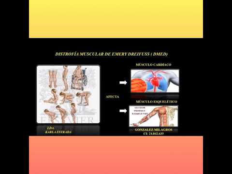 Vídeo: Distrofia Muscular (DM) Vs. Esclerose Múltipla (MS)