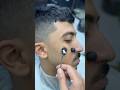 ازالة الحبايه المتسلطنة من الوجه       