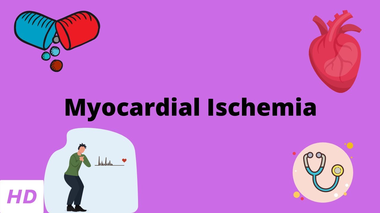 Myocardial Ischemia Causes Signs And Symptoms Diagnosis And myocardial-ischemia-causes-signs-and-symptoms-diagnosis-and