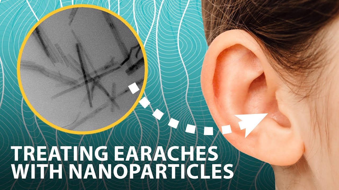 Treating earaches with nanoparticles that generate antiseptic on demand | Headline Science