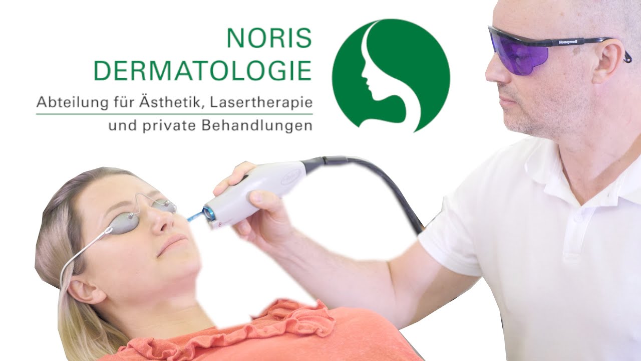 Hautarzt Noris Dermatologie Sebald - Privat Und ästhetik Laser und Ästhetik in der Noris Dermatologie - YouTube