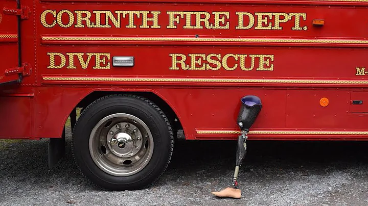 Lost Prosthetic Leg Worth $127K Rescued by Fire Department and Divers
