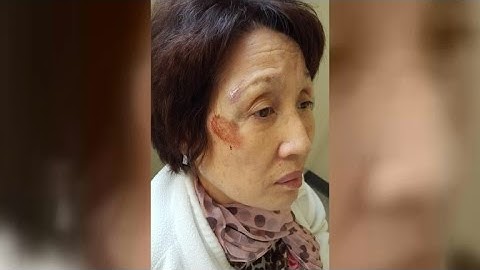 Woman accuses LAPD of roughing her up