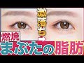 【整形級】即効で邪魔な瞼の脂肪を落としてデカ目にします!