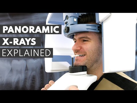 Panoramic Dental X-Ray Procedure EXPLAINED