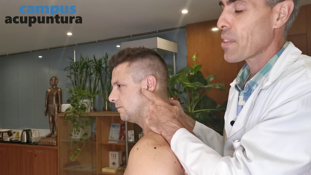 Punto x punto: Meridiano de Intestino Delgado - Prof. Raúl Ucieza | Campus Acupuntura