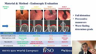 IFSO World Congress 2024 Melbourne; Correlation of the EGJ Integrity with GERD In Bariatric Surgery