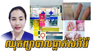 ឈុតព្យាបាលរោគស្រ្តី ធ្លាក់សរាំរ៉ៃ #Page #អ្នកគ្រូពេទ្យ_SODA