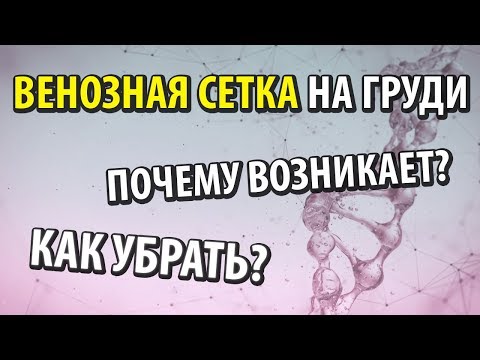 Почему возникает венозная сетка и как её убрать