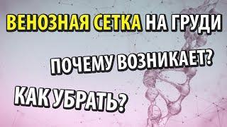 Почему возникает венозная сетка и как её убрать