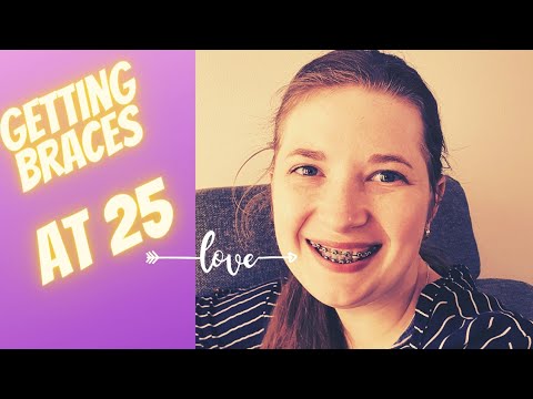 Things you should know before getting braces 😬 - YouTube