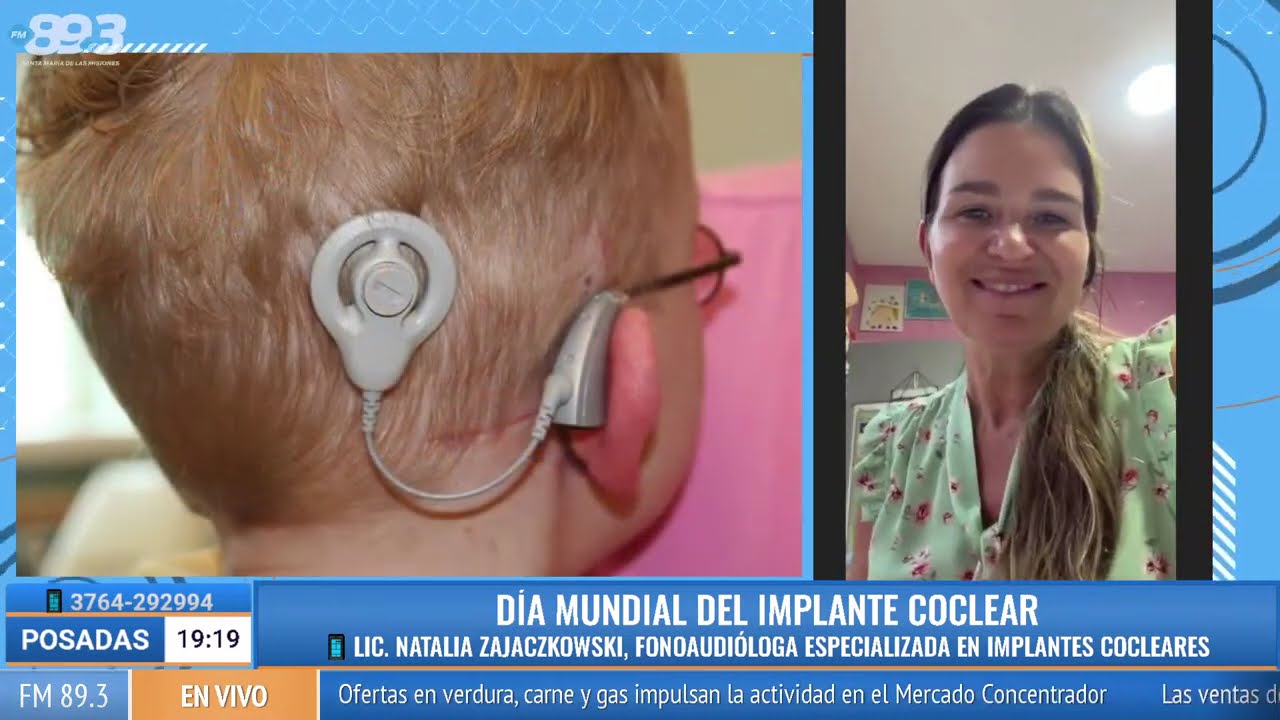 Día Mundial del Implante Coclear