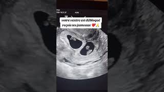 #duo #france24 #baby #bebe #maman #viralvideo #trebding #maman #funny #afrique #t_series #abonnetoi