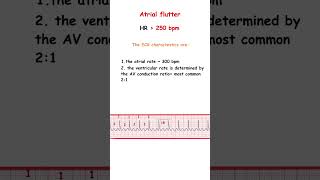 Atrial Flutter