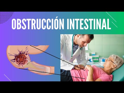 Video: ¿Aparecería una obstrucción intestinal en una ecografía?